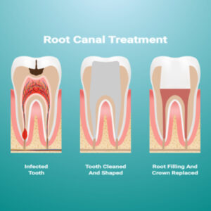 Smile Renewed: Rebecca Jones’ Journey to Dental Wellness